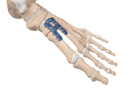 荊棘　0504 ランウォーク メンズ GORE-TEX防水 3E（1231A147-002）RUNWALK